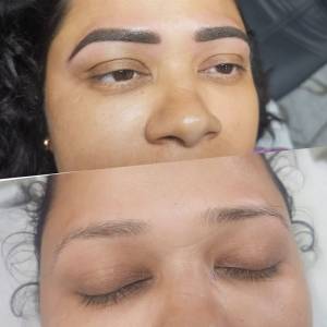 Permanent Eyebrow Enhancement in Delhi